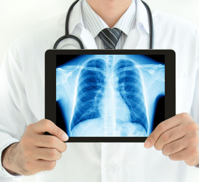Bronchitis - A Pipeline Analysis Report